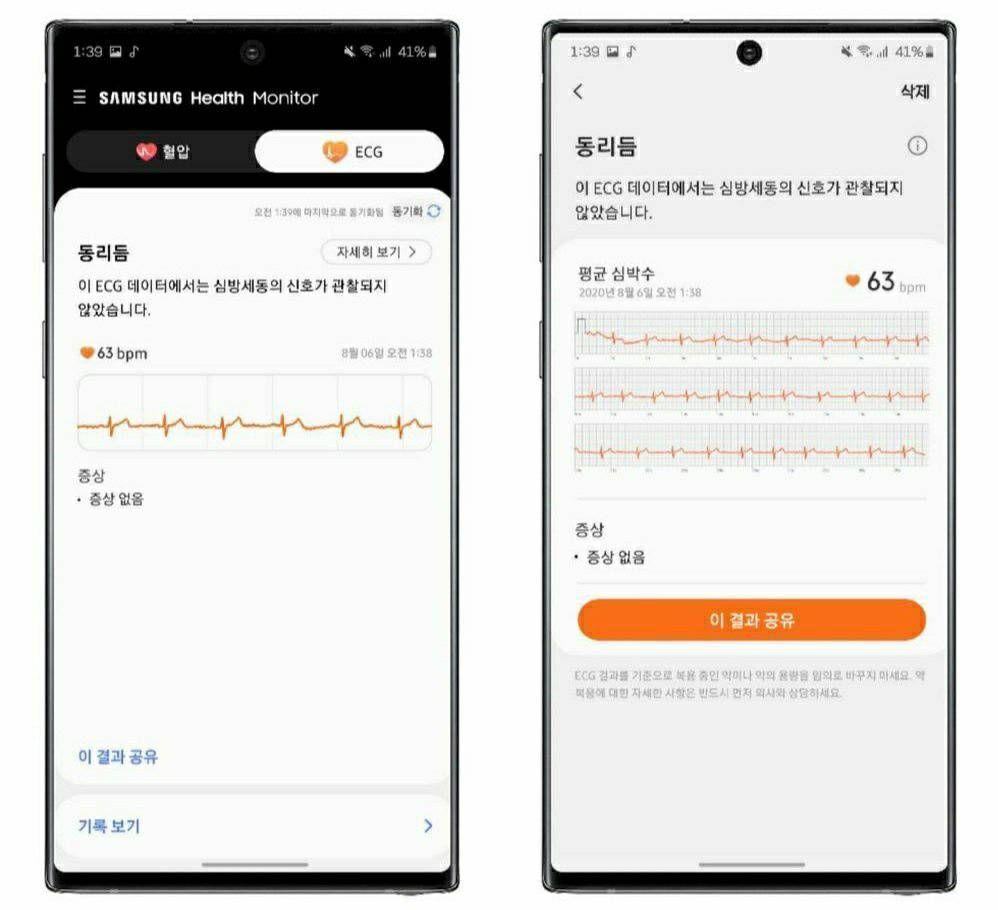 Samsung watch ecg online feature