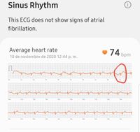 Screenshot_20201110-133123_Samsung Health Monitor_25429.jpg